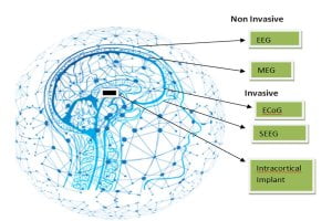 Brain Signal